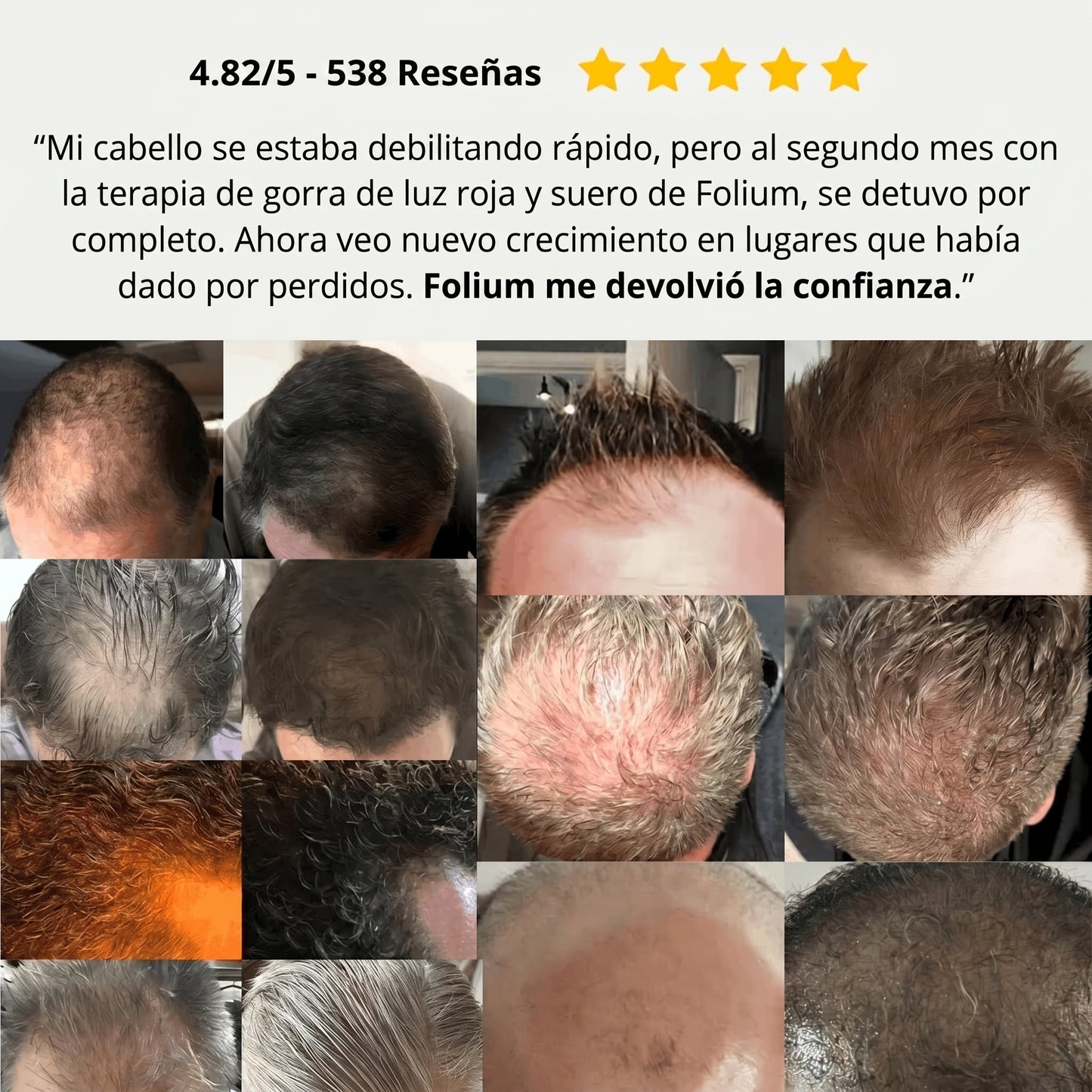 Folium Pro™ - Sistema Clínico de Terapia Láser LLLT para Regeneración Capilar