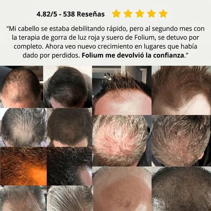 Folium Pro™ - Sistema Clínico de Terapia Láser LLLT para Regeneración Capilar