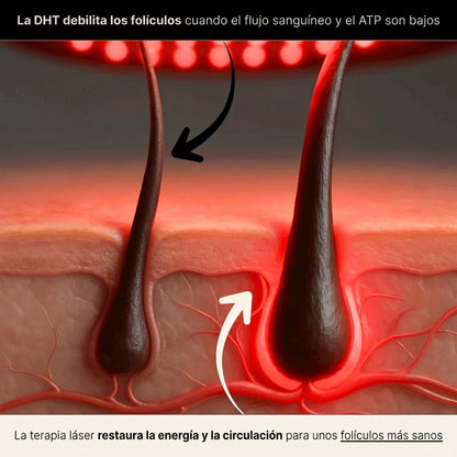 Folium Pro™ - Sistema Clínico de Terapia Láser LLLT para Regeneración Capilar